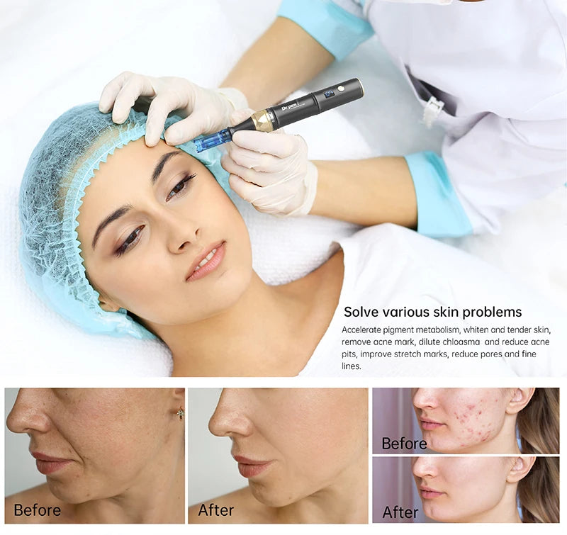 DERMA PEN DR PEN A8S PROFESIONAL