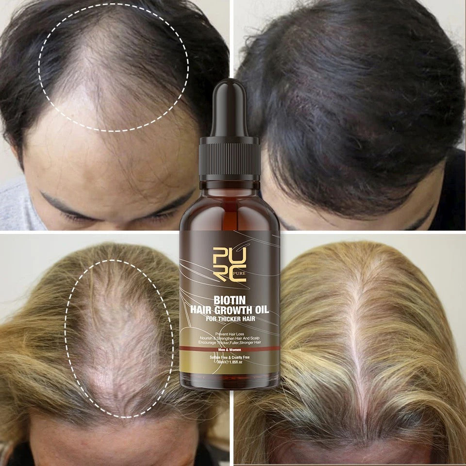 ACEITE BIOTIN PARA EL CFECIMIENTO DEL CABELLO
