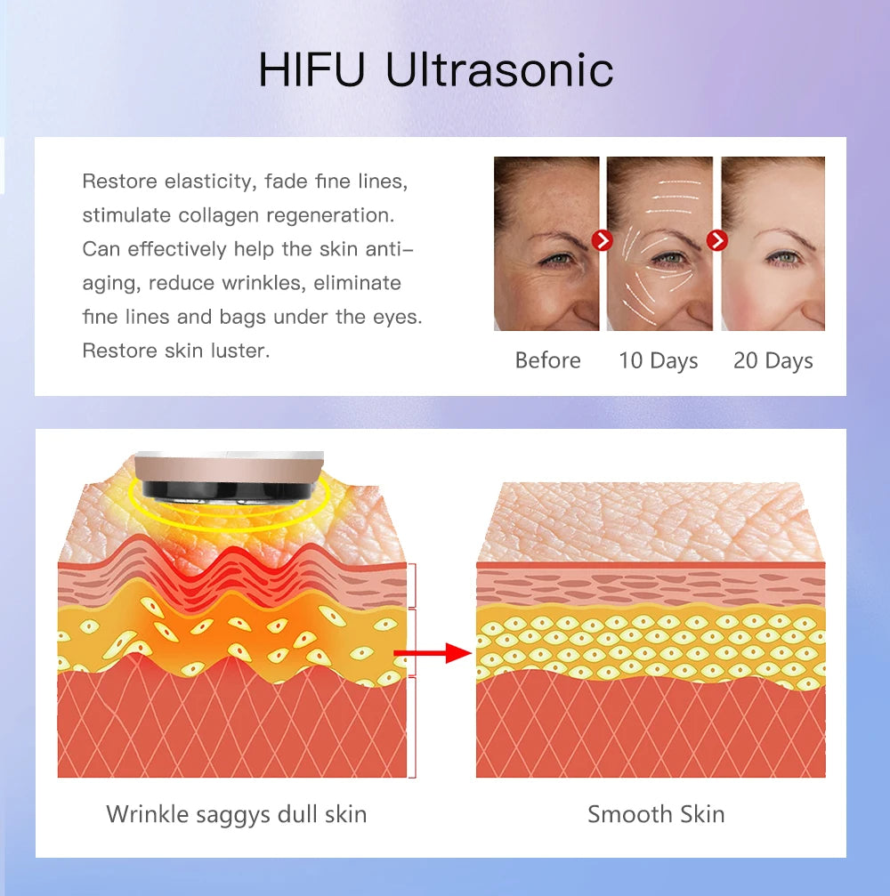 HIFU ULTRASONIDO RF LED + 120 HILOS DE COLAGENO ABSORBIBLE
