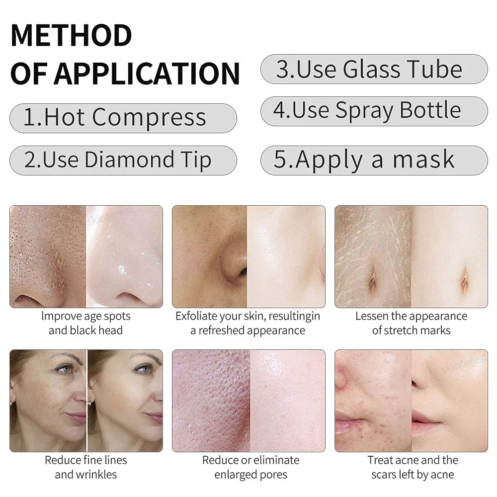 PUNTA DE DIAMANTE DERMABRASION PROFESIONAL